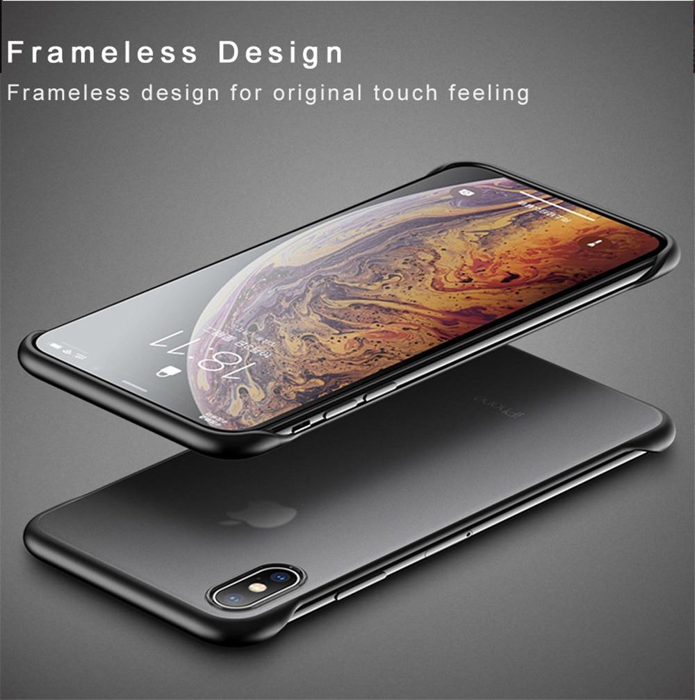 Scrub Hard Case Compatible for APPLE IPHONE X/ XS – Close Up – Accessories | Hanaya Pakistan
